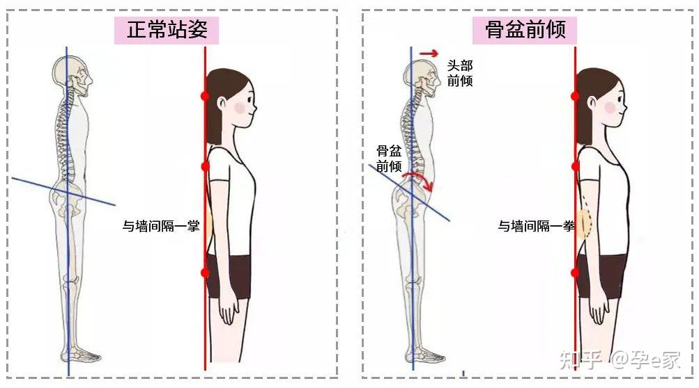 5个最伤腰的带娃动作，你却每天都在做！ - 知乎