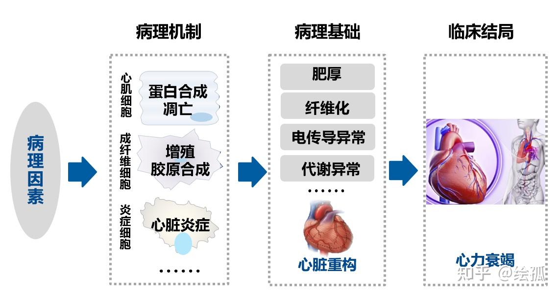 【循环系统5】心力衰竭Heart Failure,HF - 知乎