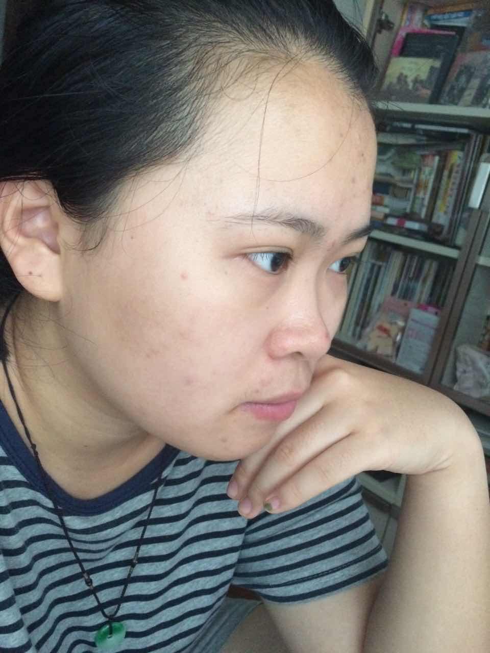 没有鼻梁是种什么体验? - 知乎