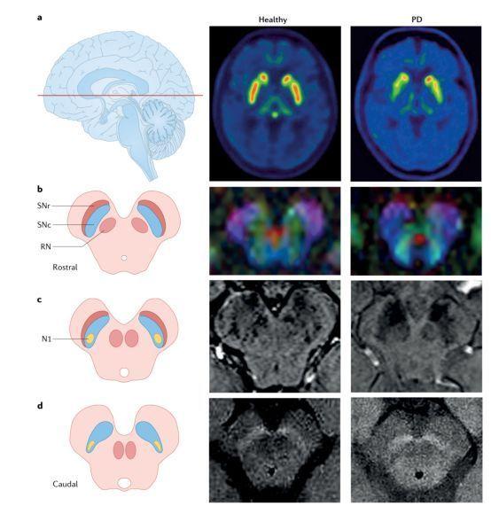 黑质纹状体图片
