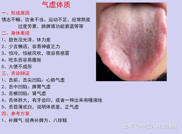 阴虚怕热、阳虚怕冷,8种体质对应8种舌象,看看你是属于哪一种? - 知乎