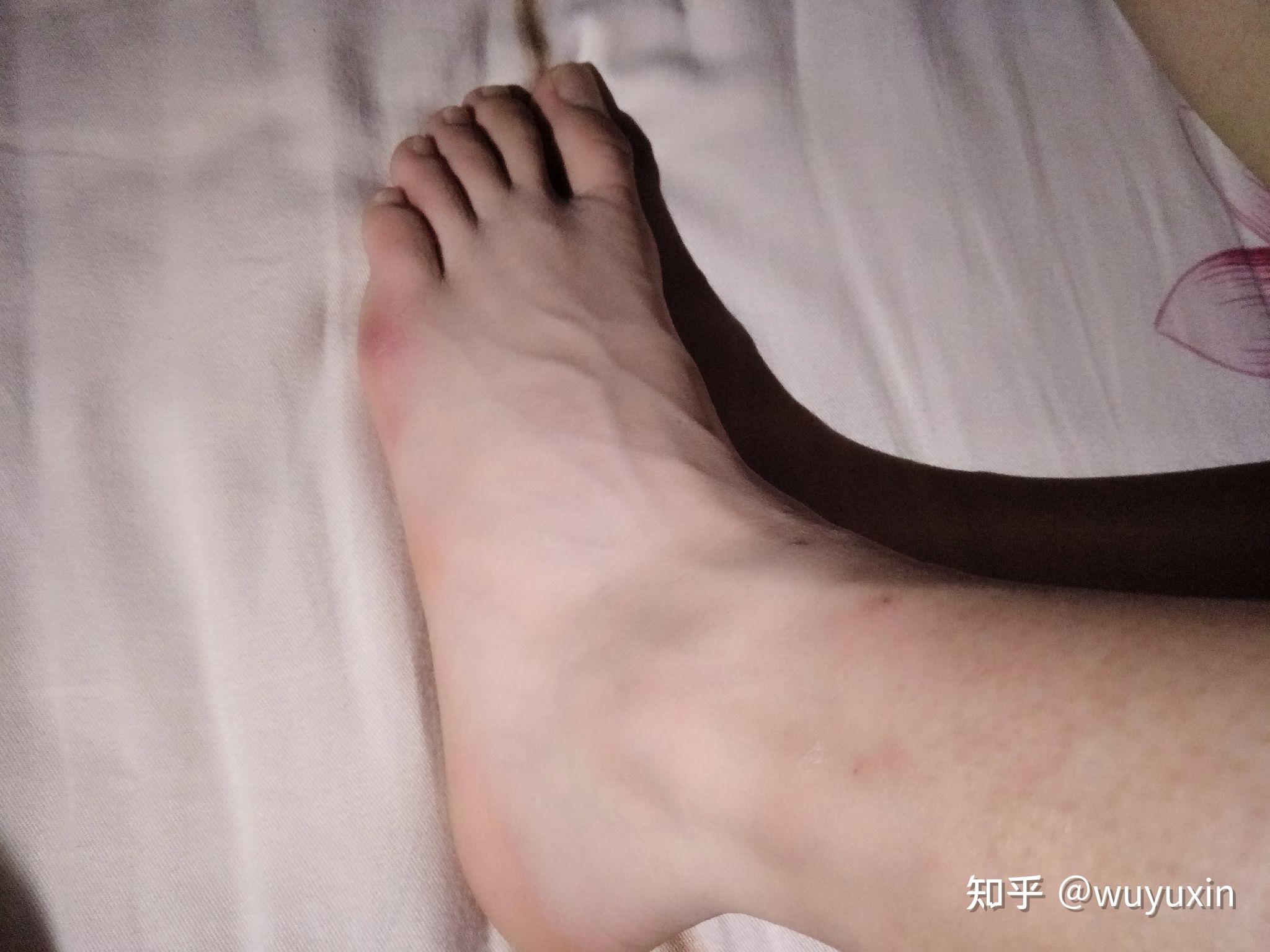 男生的脚 知乎