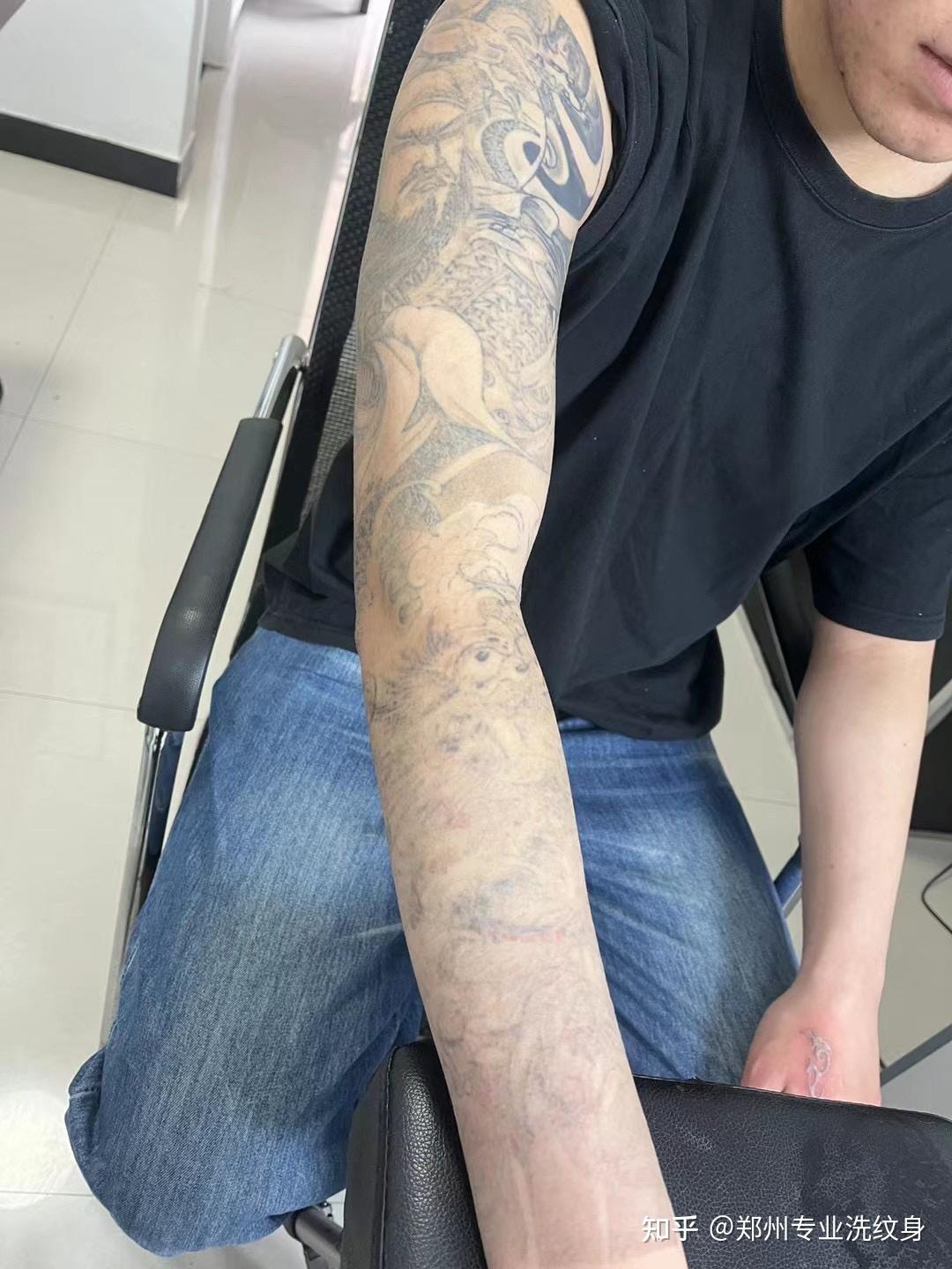 之前纹的彩色的,洗了五次没有洗掉,又纹了整个花臂,后来为了学业,还是