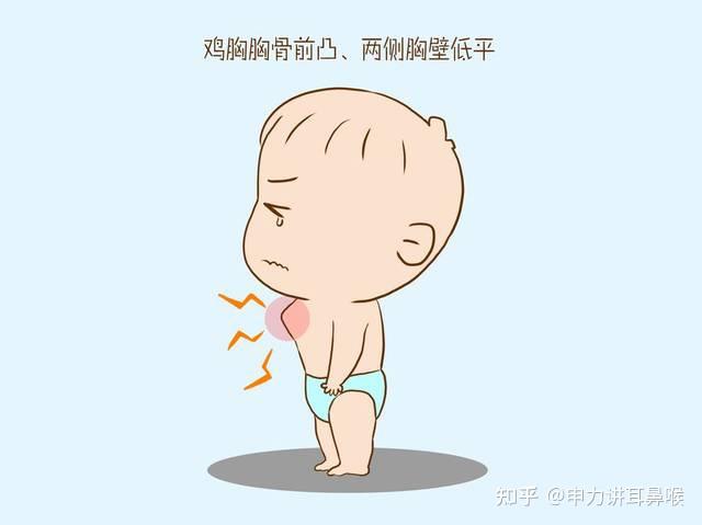 正常宝宝胸廓图片图片