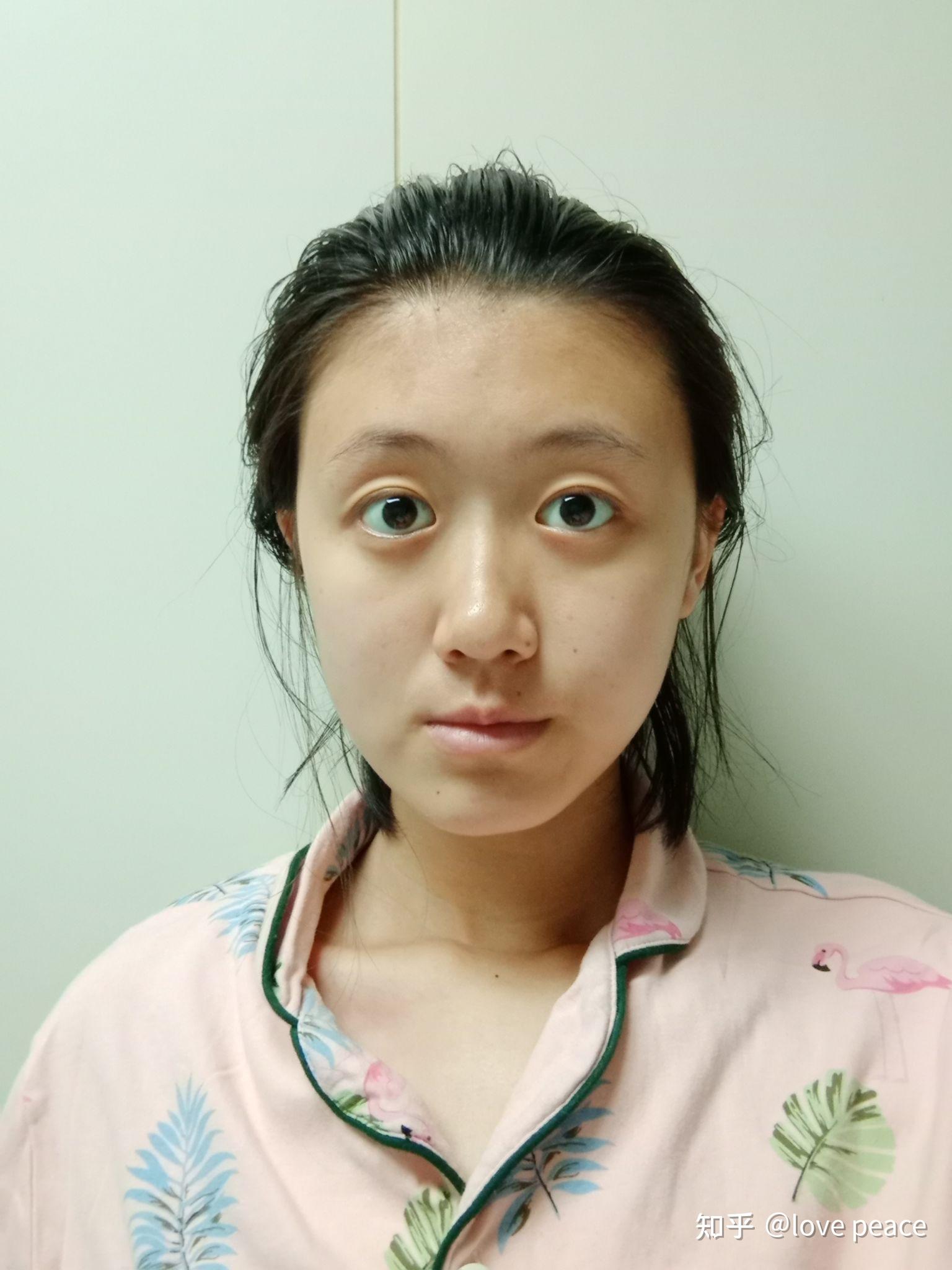 你见过蒜头鼻的美女吗