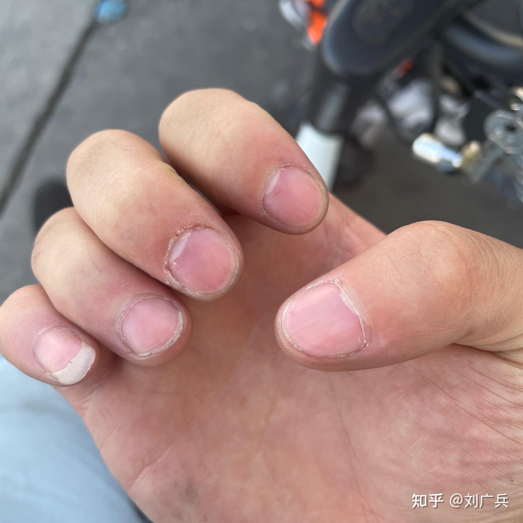 手指甲不好看的人怎么做美甲