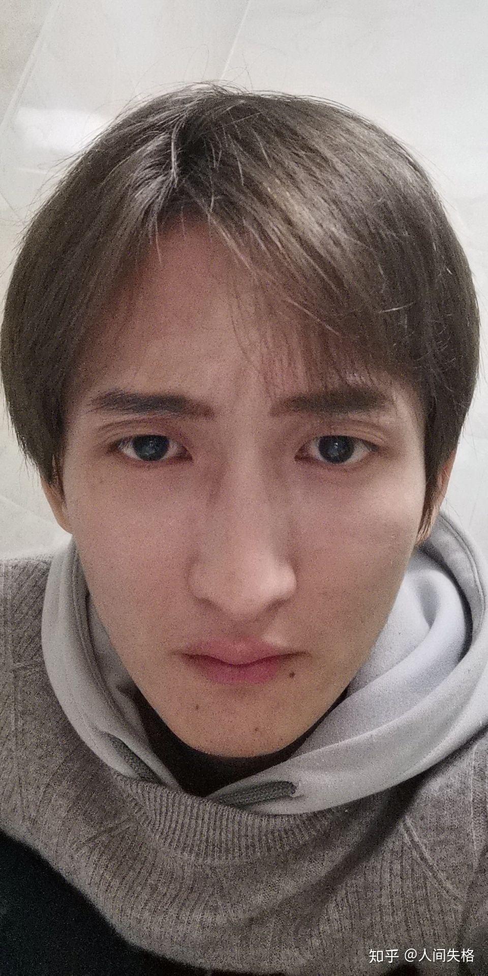 正脸正常,侧脸丑到爆是什么体验? - 知乎