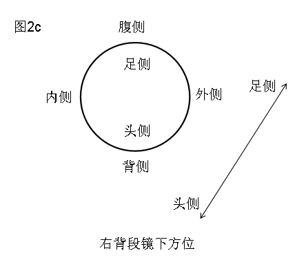 如何从ct中看懂支气管路径?图文全总结