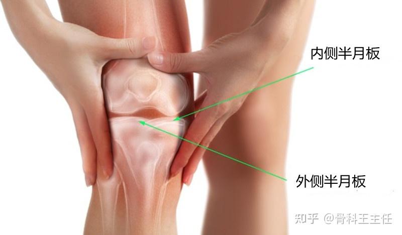 早确诊早治疗尤其重要,但也不必过于担心,无论是半月板损伤还是假性交