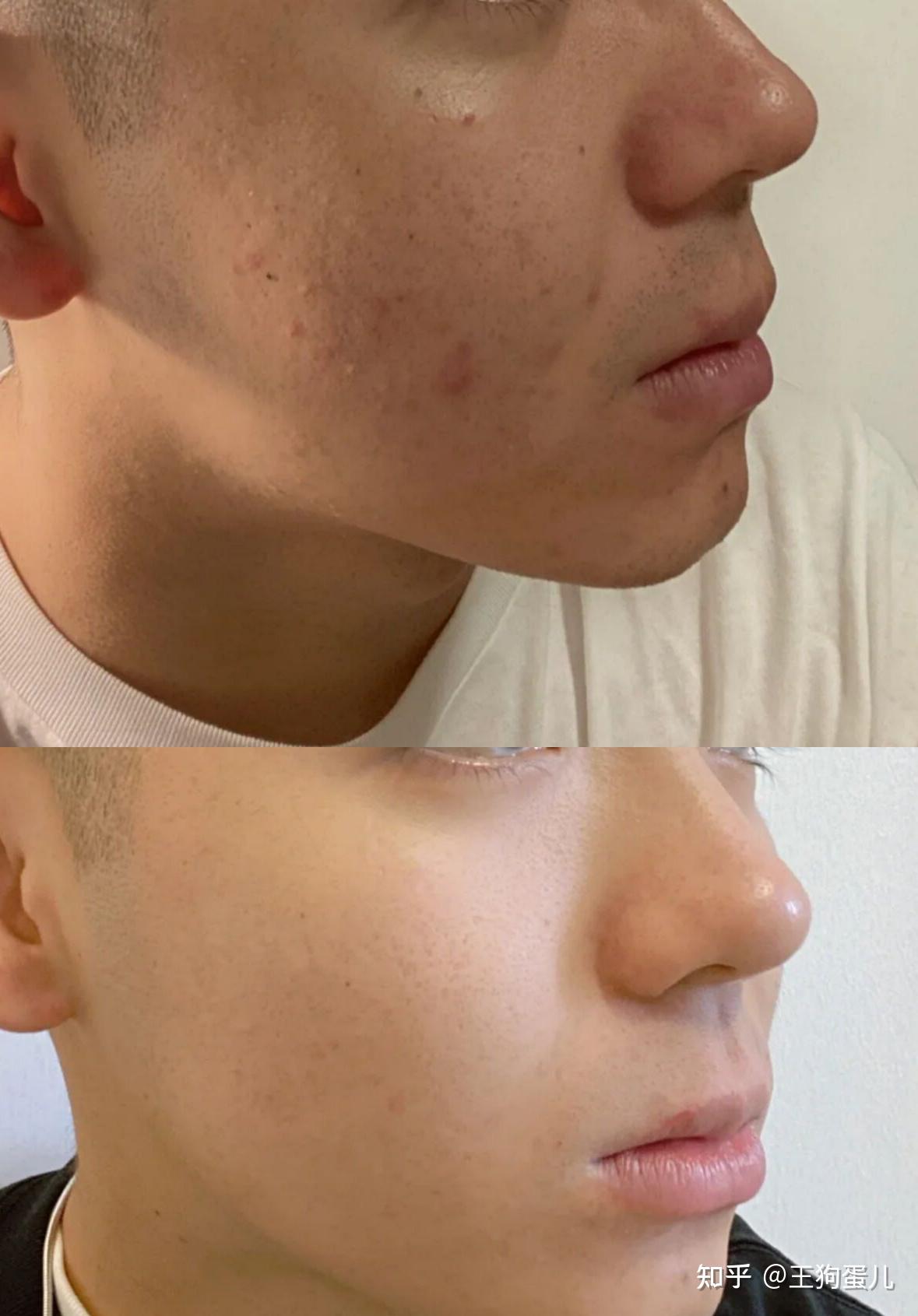 说,脸上出油滋滋的往外冒真的很难让人把这张脸跟帅挂钩所以不管咋样