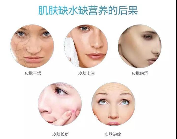 时光课堂 注氧魔法师 缺水干燥肌的救星 知乎 时光课堂 注氧魔法师 缺水干燥肌的救星 知乎