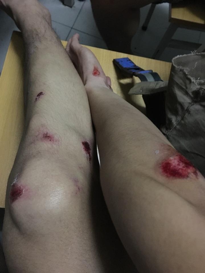 玩滑板摔倒是一种怎样的体验? - 知乎