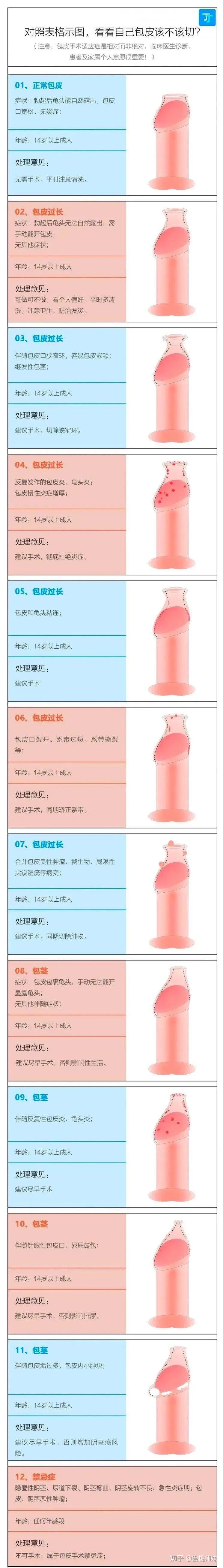 割完包皮爱爱时间会长一点要不,割了吧你怎么才三四分钟?