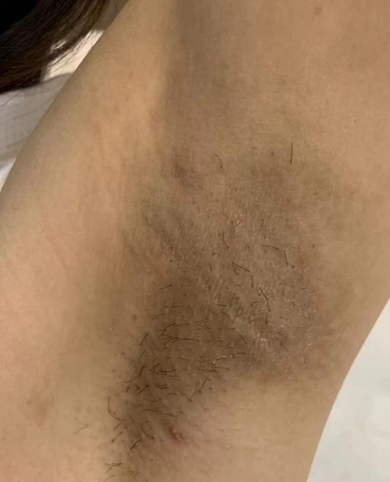 学生党可用脱毛膏推荐? - 知乎