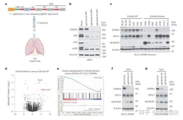 Nat Cell Biol：揭示特殊基因kdm6a在人类小细胞肺癌亚型可塑性的表观遗传调节中的重要作用 知乎