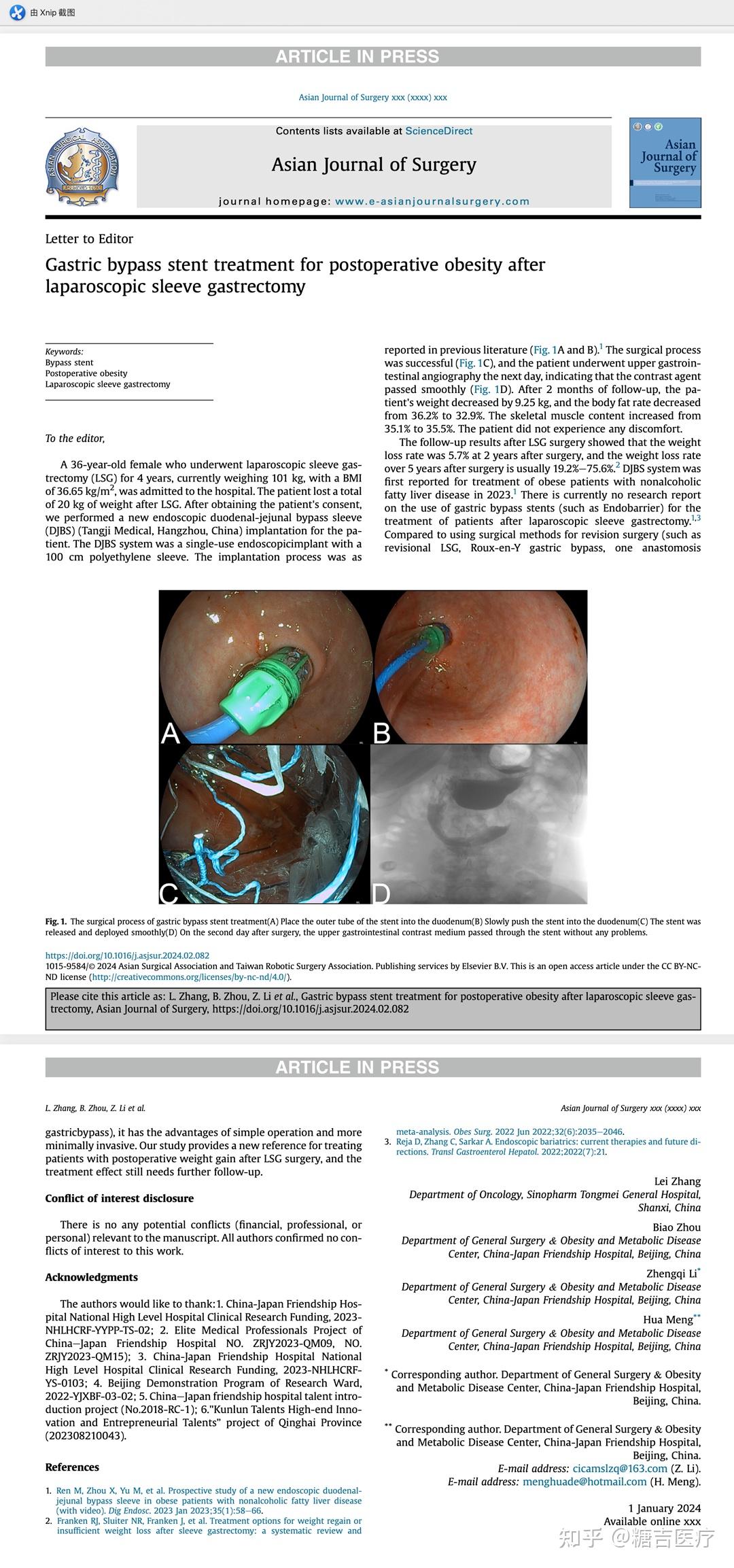 中日友好医院孟化教授团队在国际sci期刊发表:全球首例胃转流支架用于
