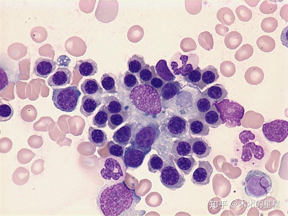 为什么哺乳动物的成熟「红细胞」一般没有细胞核? - 知乎