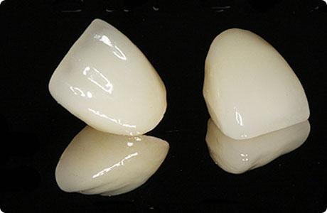 做牙冠和做了牙冠之后是一种什么体验? - 知乎