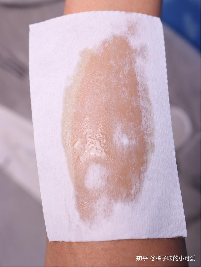 脱毛蜡纸脱毛会不会伤害皮肤