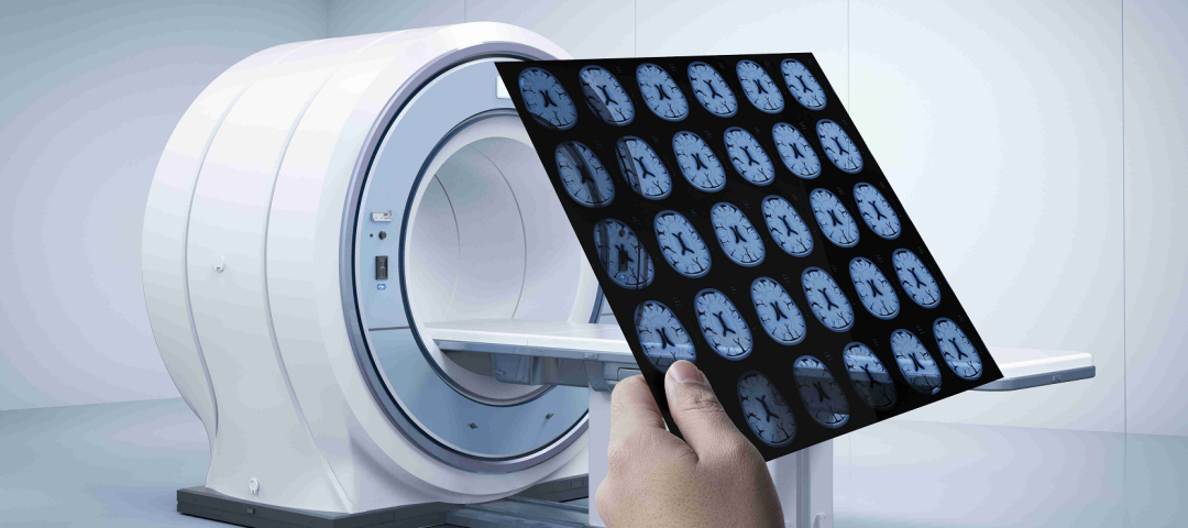 一,一万一次的pet-ct是什么,为什么这么贵?检查它有哪些好处?