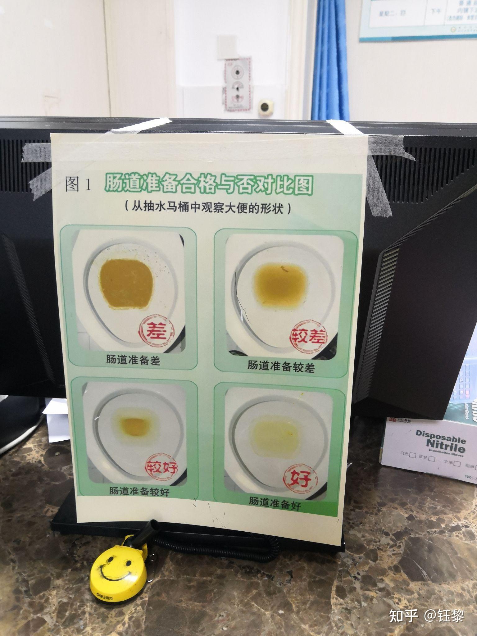 28岁女生无痛肠胃镜检查经历记录