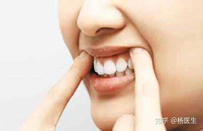 什么是牙根暴露 v2-1f4c7f8c3abe408d80718ebf1fe1d708_b.jpg