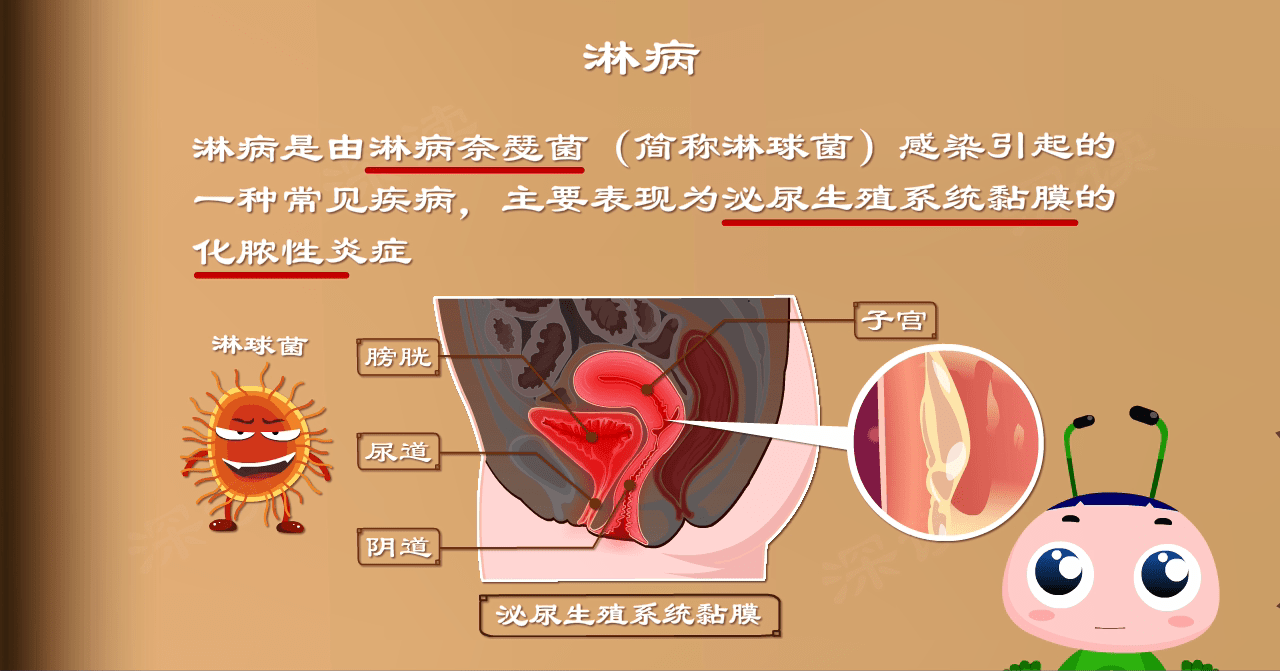 女性淋病下面 妇科图片