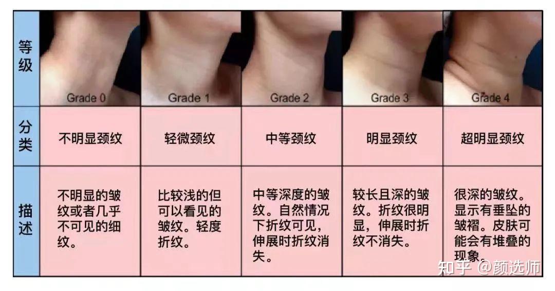 正常女性颈围图片