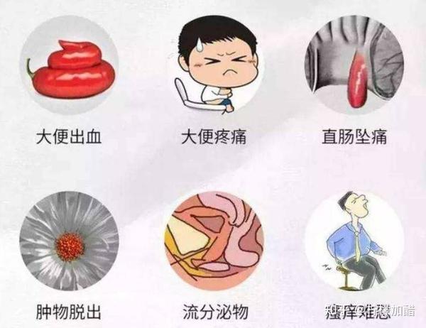 痔疮肉球便血能自愈吗?可以的,看看我是怎么做的! - 知乎