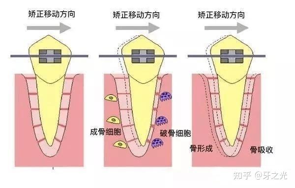 v2-1fb2465721ccc2603bb96b57497bbe88_r.jpg