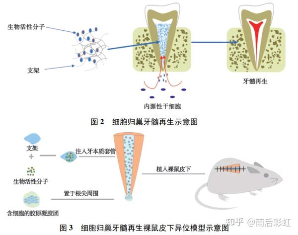 牙髓干细胞应用进展-摘取