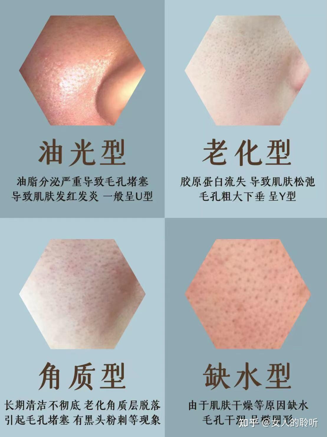 你属于哪种毛孔类型? - 知乎
