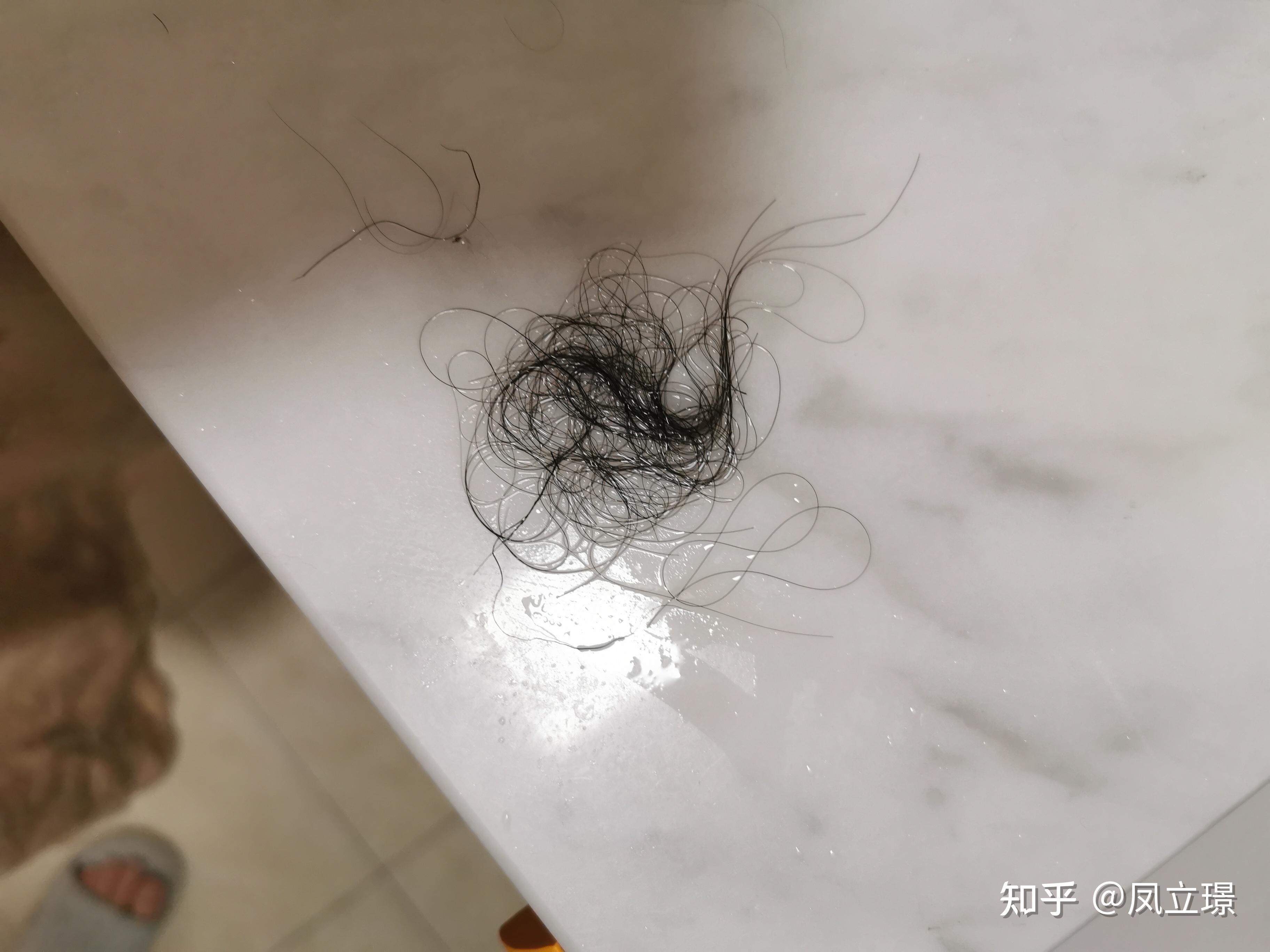 20210708,洗一次头发,差不多掉了80根,第二天去医院看了下皮肤科,医生