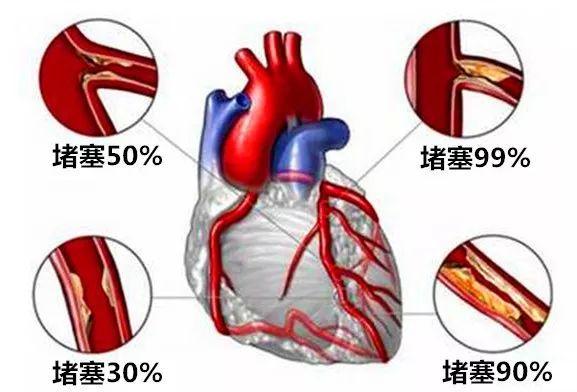 v2-2000e2274d21bebc7bff17ca9317a6da_1440w.jpg?source=172ae18b