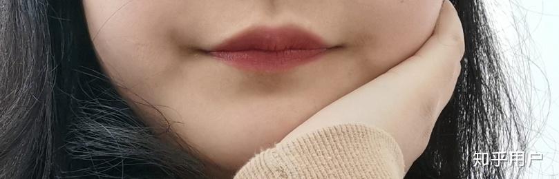 上嘴唇上翘,上翻怎么办?侧面看起来简直丑哭我! - 知乎
