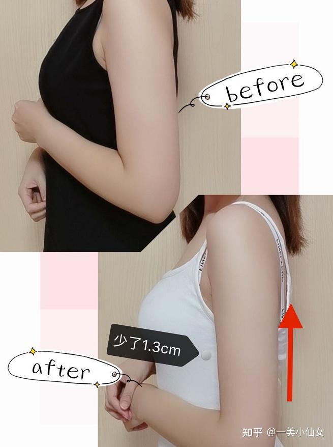 酷塑冷冻溶脂是智商税吗到底有没有效果