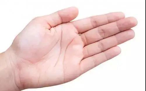 广东一女子手指肿胀竟被查出了癌症和匠为你说清真相