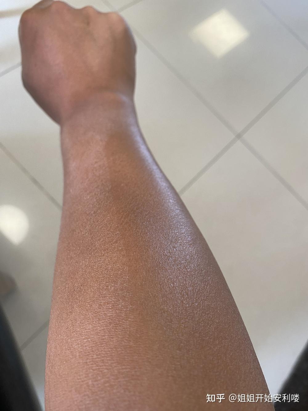 秋冬身上干燥脱皮,擦身体乳又很油很闷怎么办? - 知乎