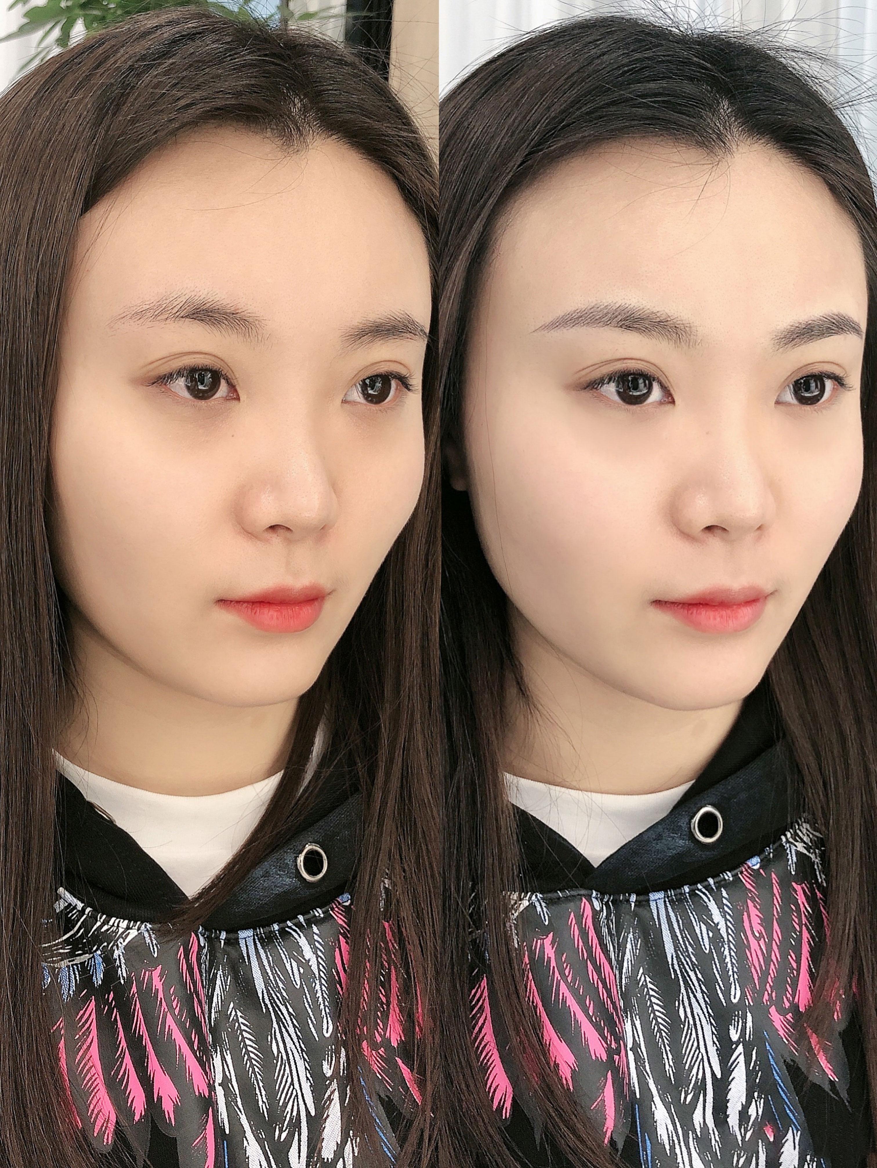 柒号美学纹唇以后的注意事项有哪些? - 知乎