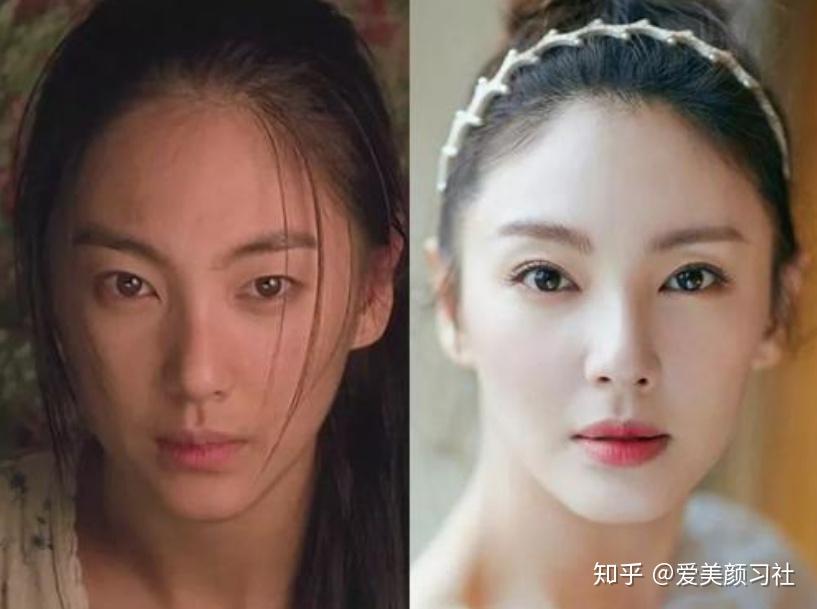 开扇形双眼皮是内双吗? - 知乎