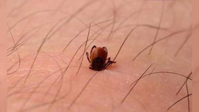 一口一个洞还不能拔孩子被草爬子咬了怎么办