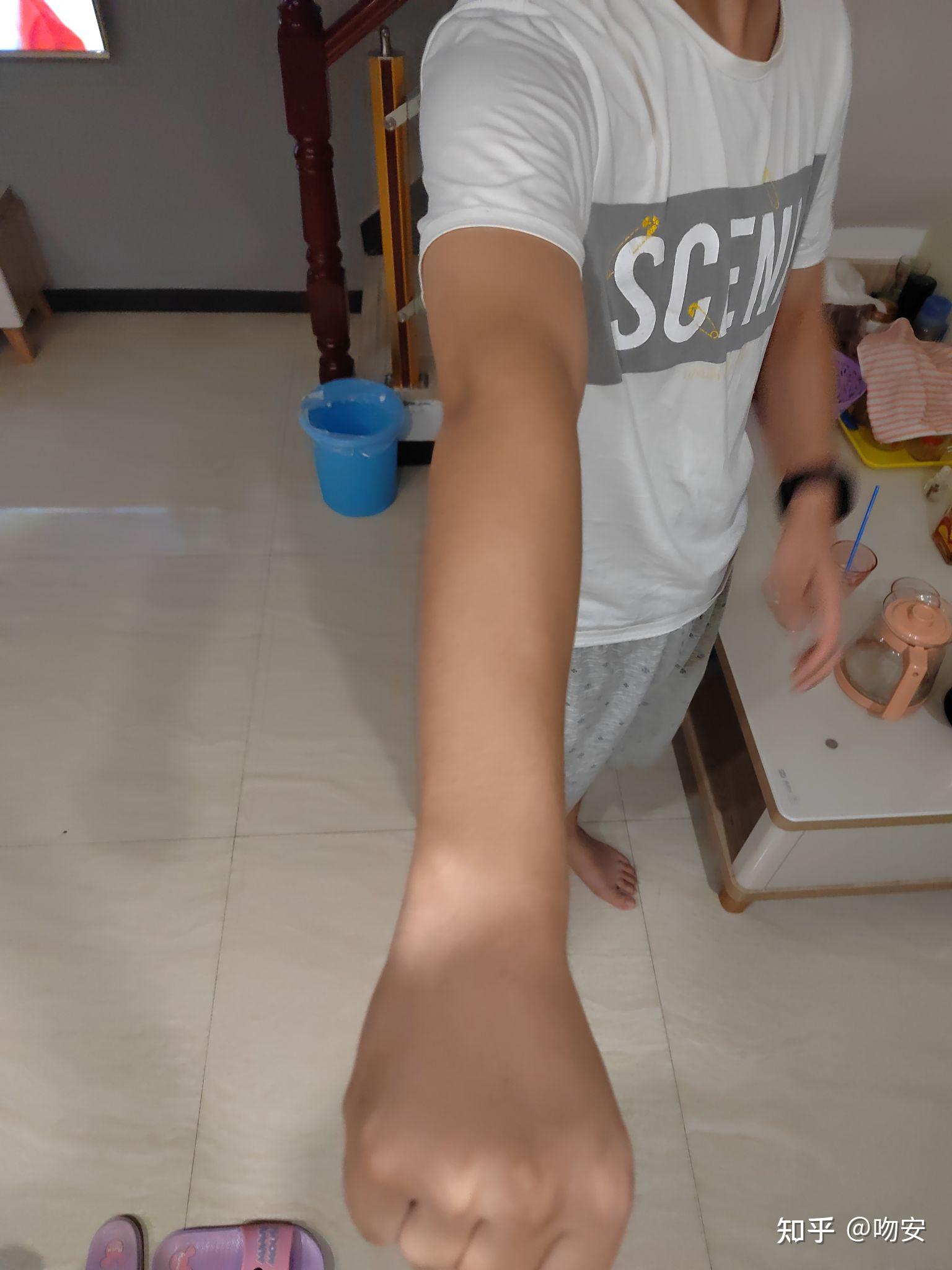 我想问一下我的这个算肘外翻吗?军检有没有问题?