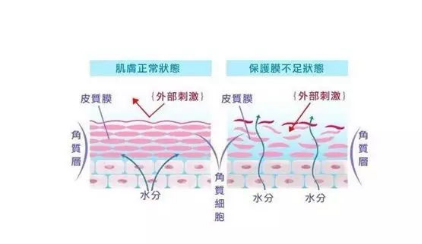 Wis 拯救 沙漠肌 的正确方式在这里 知乎