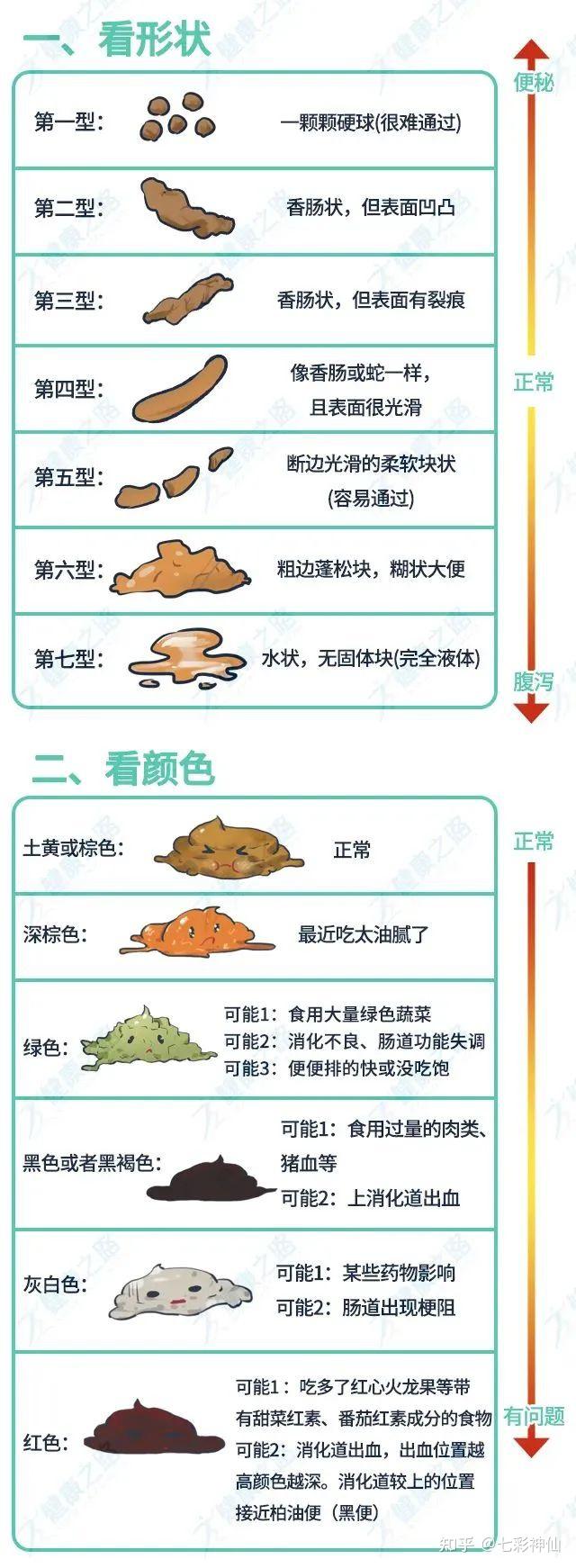 排便像这样,是肠道出现问题了吗? - 知乎