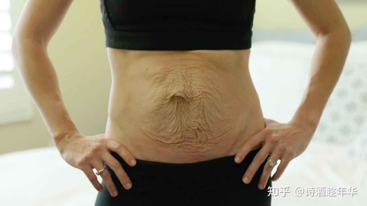 羡慕人家生双胞胎？先看看怀双胞胎风险吧 - 知乎