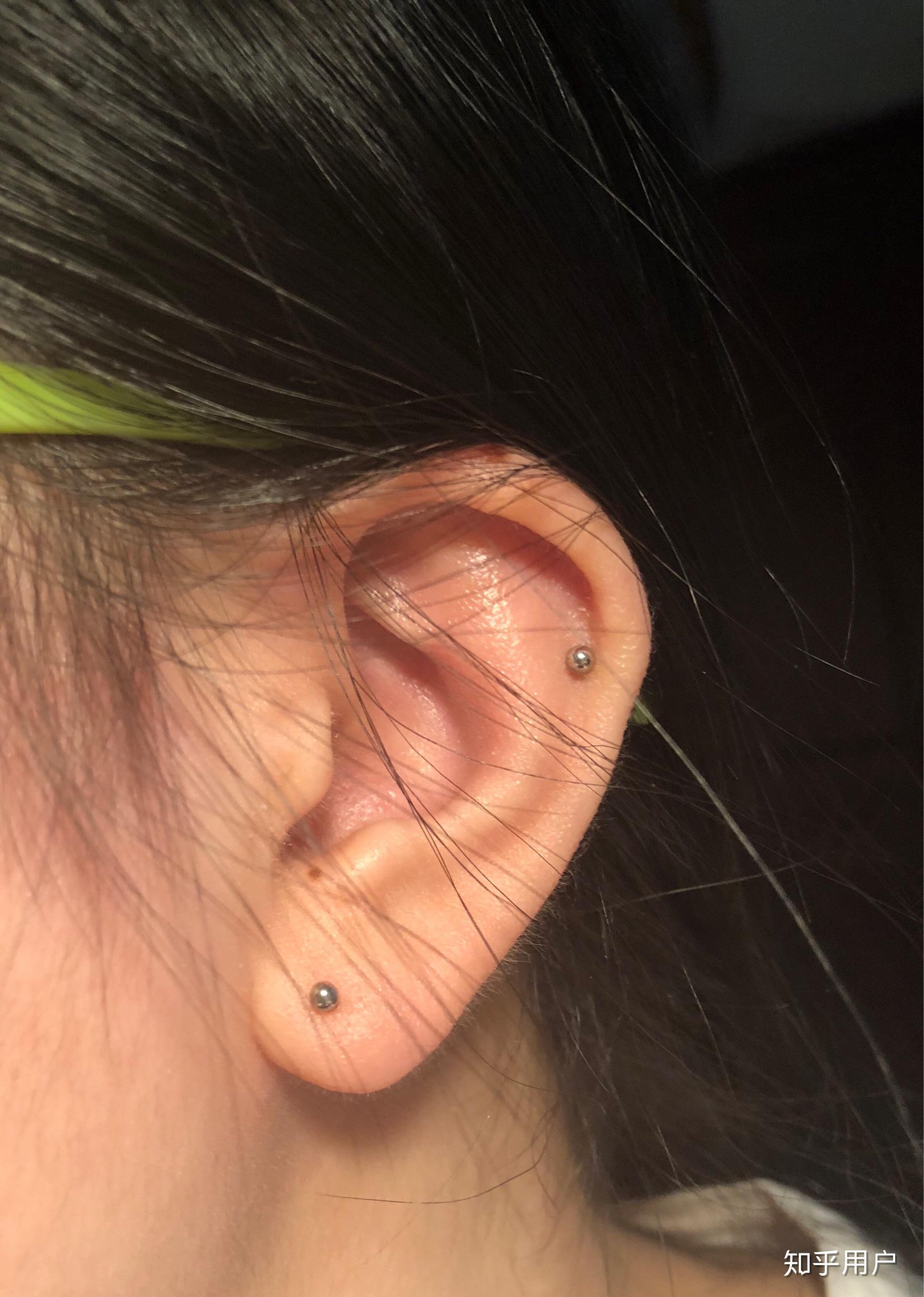 打在耳骨上回疼吗听人说会引起面瘫求何为耳洞专家指导怎样能有效避免
