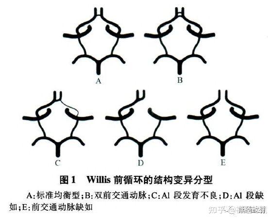 willis动脉环组成图片