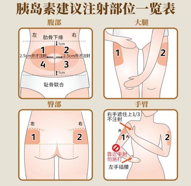 v2-2223b7941de5aad4ad083a206900a36c_r.jpg