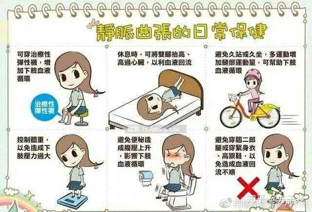 教你6个妙招有效预防静脉曲张