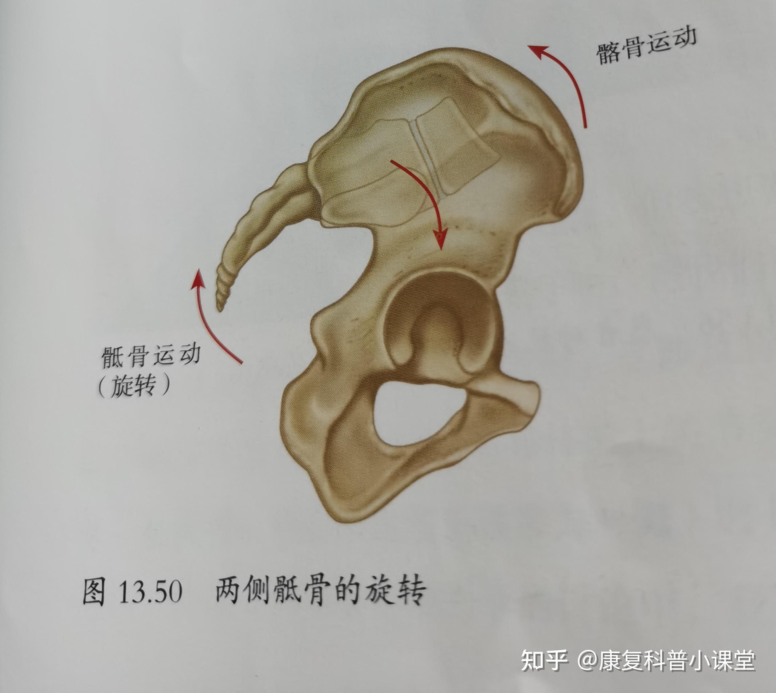 如何治疗盆骨倾斜? 